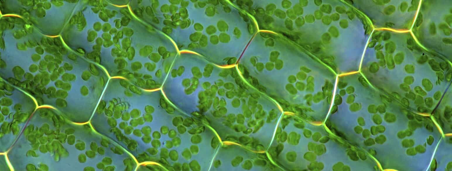 På et lysmikroskop-billede af bladet fra en vandpest (Elodea canadensis) ses de rektangulære celler med talrige kloroplaster