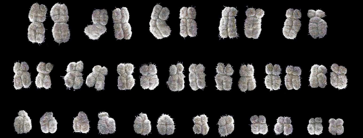 SEM-billede af et udpluk af menneskets 23 kromosompar