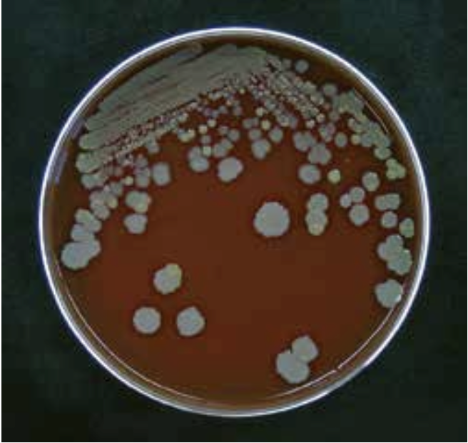 Vækst af 2 forskellige bakteriearter på blodagarplade