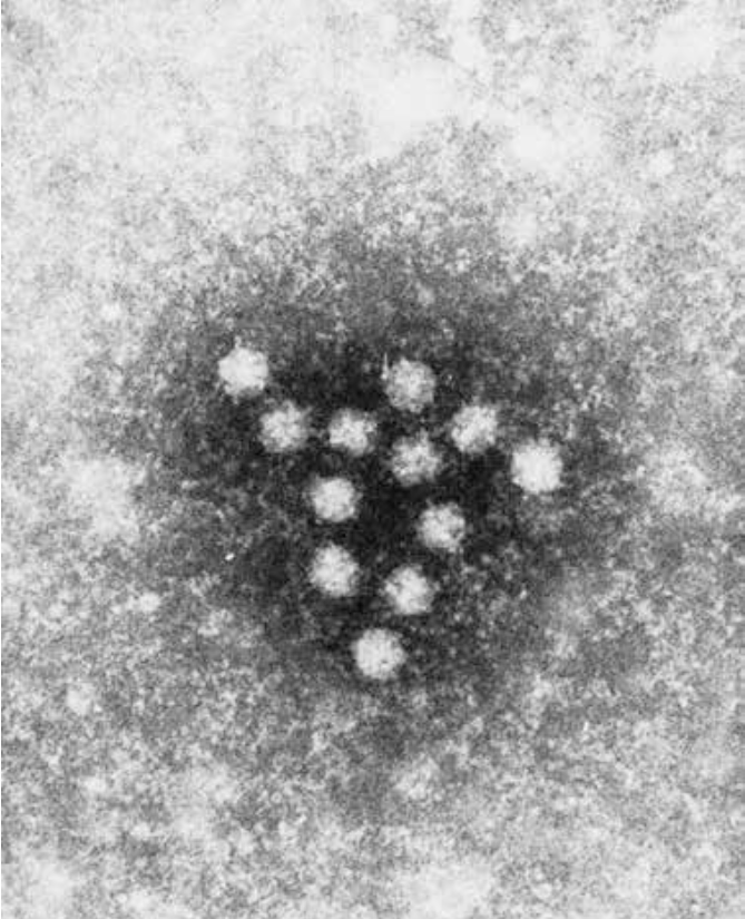 Elektronmikroskopisk foto af parvovirus B19