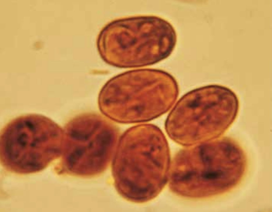 Giardia intestinalis cyster