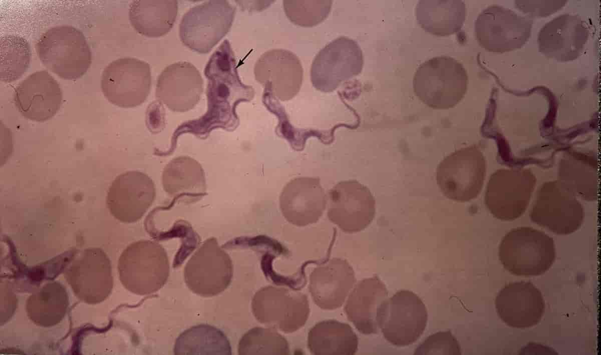 Trypanosoma rhodesiense