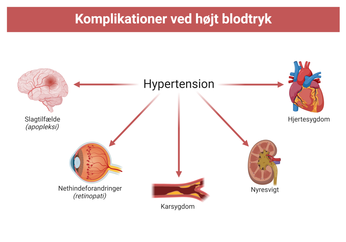 Komplikationer ved hypertension